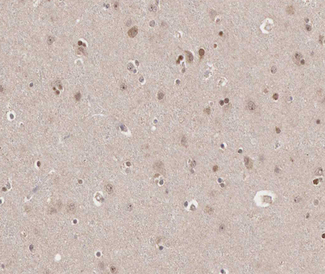TRADD Antibody - 1:100 staining human brain tissue by IHC-P. The tissue was formaldehyde fixed and a heat mediated antigen retrieval step in citrate buffer was performed. The tissue was then blocked and incubated with the antibody for 1.5 hours at 22°C. An HRP conjugated goat anti-rabbit antibody was used as the secondary.