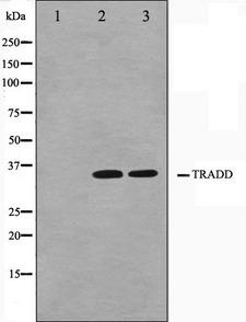TRADD Antibody - Western blot analysis on COS7 and HuvEc cell lysates using TRADD antibody. The lane on the left is treated with the antigen-specific peptide.