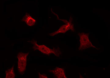 TRADD Antibody - Staining COS7 cells by IF/ICC. The samples were fixed with PFA and permeabilized in 0.1% Triton X-100, then blocked in 10% serum for 45 min at 25°C. The primary antibody was diluted at 1:200 and incubated with the sample for 1 hour at 37°C. An Alexa Fluor 594 conjugated goat anti-rabbit IgG (H+L) Ab, diluted at 1/600, was used as the secondary antibody.