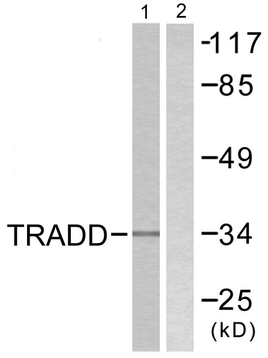 TRADD Antibody - Western blot analysis of extracts from COS7 cells, using TRADD antibody.
