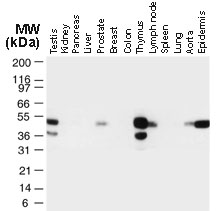 TRAF1 Antibody - Western blot of TRAF1 in normal human tissues using Polyclonal Antibody to TRAF1 at 1:2000. TRAF1 is observed at 50-50 kD. Additional bands of lower molecular weight were seen in some cases, and may represent TRAF1 degradation fragments.