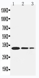 TRAF1 Antibody - WB of TRAF1 antibody. Recombinant Protein Detection Source:. E.coli derived -recombinant Human TRAF1, 30.6KD. (162aa tag+ E174-E282). . Lane1: Recombinant Human TRAF1 Protein 5ng. Lane2: Recombinant Human TRAF1 Protein 2.5ng. Lane3: Recombinant Human TRAF1 Protein 1.25ng..