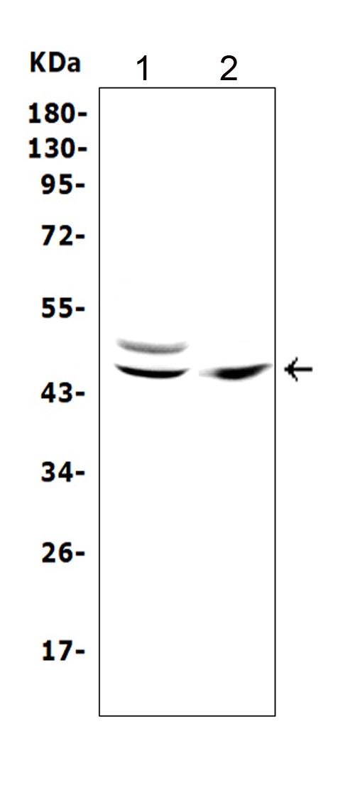 TRAF1 Antibody - Western blot analysis of TRAF1 using anti-TRAF1 antibody. Electrophoresis was performed on a 5-20% SDS-PAGE gel at 70V (Stacking gel) / 90V (Resolving gel) for 2-3 hours. The sample well of each lane was loaded with 50ug of sample under reducing conditions. Lane 1: human Raji whole cell lysates, Lane 2: human T-47D whole cell lysates. After Electrophoresis, proteins were transferred to a Nitrocellulose membrane at 150mA for 50-90 minutes. Blocked the membrane with 5% Non-fat Milk/ TBS for 1.5 hour at RT. The membrane was incubated with rabbit anti-TRAF1 antigen affinity purified polyclonal antibody at 0.5 µg/mL overnight at 4°C, then washed with TBS-0.1% Tween 3 times with 5 minutes each and probed with a goat anti-rabbit IgG-HRP secondary antibody at a dilution of 1:10000 for 1.5 hour at RT. The signal is developed using an Enhanced Chemiluminescent detection (ECL) kit with Tanon 5200 system. A specific band was detected for TRAF1 at approximately 46KD. The expected band size for TRAF1 is at 46KD.