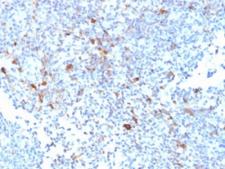 TRAF1 Antibody - IHC testing of FFPE human lymph node with TRAF1 antibody. HIER: boil tissue sections in pH6, 10mM citrate buffer, for 10-20 min followed by cooling at RT for 20 min.