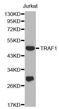 TRAF1 Antibody - Western blot analysis of extracts of Jurkat cell line, using TRAF1 antibody.
