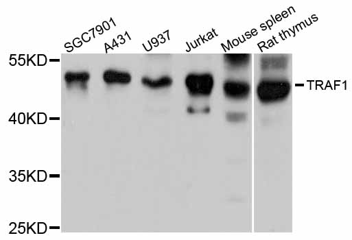 TRAF1 Antibody - Western blot analysis of extracts of various cell lines, using TRAF1 antibody at 1:3000 dilution. The secondary antibody used was an HRP Goat Anti-Rabbit IgG (H+L) at 1:10000 dilution. Lysates were loaded 25ug per lane and 3% nonfat dry milk in TBST was used for blocking. An ECL Kit was used for detection and the exposure time was 10s.