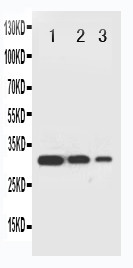 TRAF2 Antibody - WB of TRAP / TRAF2 antibody. Recombinant Protein Detection Source:. E.coli derived -recombinant Human TRAF2, 30.4KD. (162aa tag+ Q261-V369). . Lane1: Recombinant Human TRAF2 Protein 10ng. Lane2: Recombinant Human TRAF2 Protein 5ng. Lane3: Recombinant Human TRAF2 Protein 2.5ng..