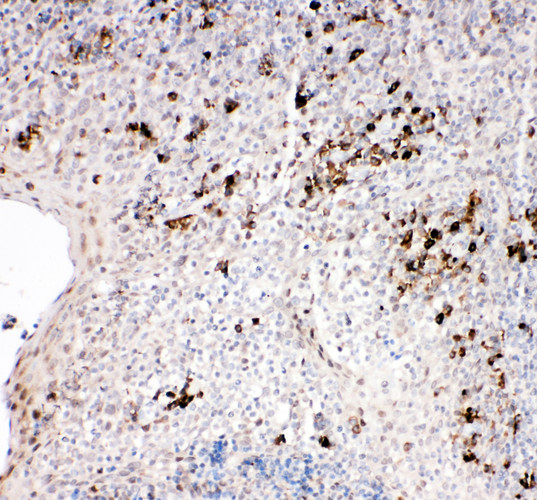 TRAF2 Antibody - TRAP / TRAF2 antibody. IHC(P): Human Tonsil Tissue.