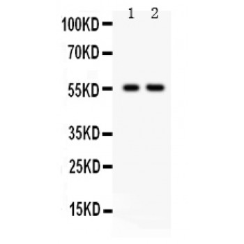 TRAF2 Antibody - TRAF2 antibody Western blot. All lanes: Anti TRAF2 at 0.5 ug/ml. Lane 1: HELA Whole Cell Lysate at 40 ug. Lane 2: JURKAT Whole Cell Lysate at 40 ug. Predicted band size: 56 kD. Observed band size: 56 kD.