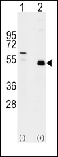 TRAF2 Antibody - Western blot of TRAF2 (arrow) using rabbit polyclonal TRAF2 Antibody. 293 cell lysates (2 ug/lane) either nontransfected (c) or transiently transfected with the TRAF2 gene (Lane 2) (Origene Technologies).