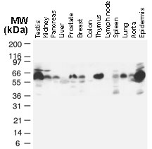 TRAF2 Antibody - Western blot of TRAF2 in normal human tissues using Polyclonal Antibody to TRAF2 at 1:2000. TRAF2 is observed at ~60-64 kD. Additional bands of lower molecular weight were seen in some cases, and may represent TRAF2 degradation fragments