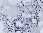 TRAF2 Antibody - IHC of TRAF2 in formalin-fixed, paraffin-embedded normal human bone marrow section using Polyclonal Antibody to TRAF2 at 1:2000. Hematoxylin-Eosin counterstain.