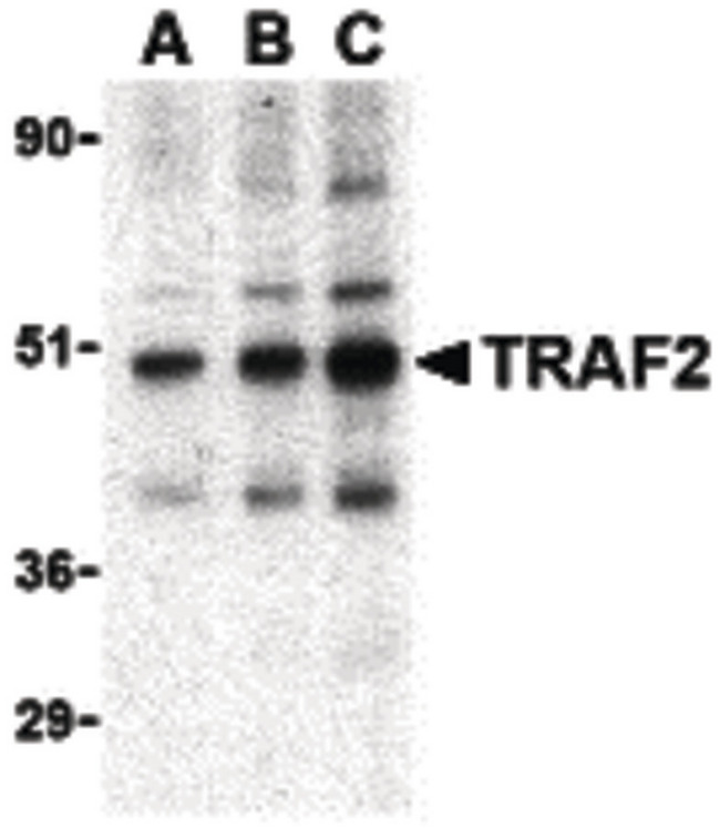 TRAF2 Antibody - Western blot of TRAF2 in mouse liver tissue lysate with TRAF2 antibody at (A) 0.5, (B) 1 and (C) 2 ug/ml.