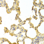 TRAF2 Antibody - Immunohistochemistry of paraffin-embedded rat lung tissue.