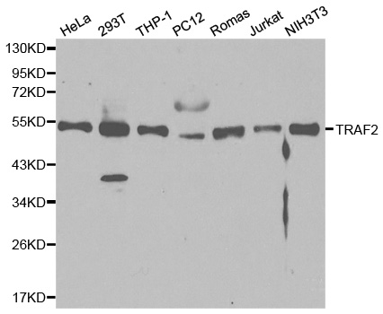 TRAF2 Antibody - Western blot analysis of extracts of various cell lines, using TRAF2 antibody at 1:1000 dilution. The secondary antibody used was an HRP Goat Anti-Rabbit IgG (H+L) at 1:10000 dilution. Lysates were loaded 25ug per lane and 3% nonfat dry milk in TBST was used for blocking.