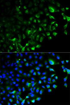 TRAF2 Antibody - Immunofluorescence analysis of HeLa cells using TRAF2 antibody. Blue: DAPI for nuclear staining.