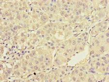 TRAF2 Antibody - Immunohistochemistry of paraffin-embedded human liver cancer at dilution of 1:100