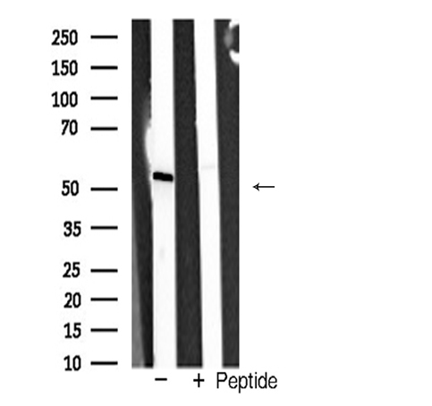 TRAF2 Antibody - Western blot analysis of TRAF2 expression in PC-12 cells