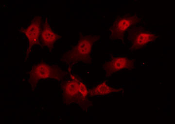 TRAF2 Antibody - Staining K562 cells by IF/ICC. The samples were fixed with PFA and permeabilized in 0.1% Triton X-100, then blocked in 10% serum for 45 min at 25°C. The primary antibody was diluted at 1:200 and incubated with the sample for 1 hour at 37°C. An Alexa Fluor 594 conjugated goat anti-rabbit IgG (H+L) Ab, diluted at 1/600, was used as the secondary antibody.