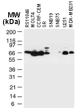 TRAF3 Antibody - Western blot of TRAF3 in various tumor cell lines using Polyclonal Antibody to TRAF3 at 1:2000. TRAF3 is observed at ~67 kD.