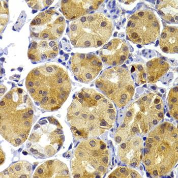 TRAF3 Antibody - Immunohistochemistry of paraffin-embedded human stomach using TRAF3 antibodyat dilution of 1:100 (40x lens).
