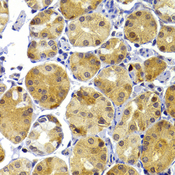 TRAF3 Antibody - Immunohistochemistry of paraffin-embedded human stomach using TRAF3 antibodyat dilution of 1:100 (40x lens).
