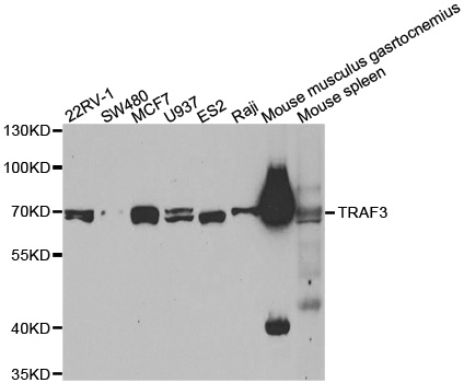 TRAF3 Antibody - Western blot analysis of extracts of various cell lines.