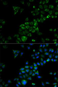 TRAF3 Antibody - Immunofluorescence analysis of HeLa cells.
