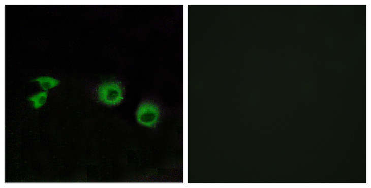 TRAF3IP1 Antibody - Immunofluorescence analysis of MCF7 cells, using MIPT3 Antibody. The picture on the right is blocked with the synthesized peptide.