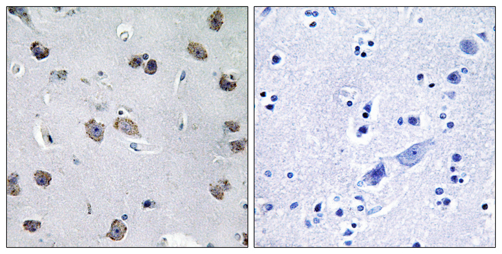 TRAF3IP1 Antibody - Immunohistochemistry analysis of paraffin-embedded human brain tissue, using MIPT3 Antibody. The picture on the right is blocked with the synthesized peptide.