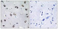 TRAF3IP1 Antibody - Immunohistochemistry analysis of paraffin-embedded human brain tissue, using MIPT3 Antibody. The picture on the right is blocked with the synthesized peptide.