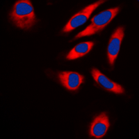 TRAF3IP1 Antibody - Immunofluorescent analysis of TRAF3IP1 staining in HeLa cells. Formalin-fixed cells were permeabilized with 0.1% Triton X-100 in TBS for 5-10 minutes and blocked with 3% BSA-PBS for 30 minutes at room temperature. Cells were probed with the primary antibody in 3% BSA-PBS and incubated overnight at 4 C in a humidified chamber. Cells were washed with PBST and incubated with a DyLight 594-conjugated secondary antibody (red) in PBS at room temperature in the dark. DAPI was used to stain the cell nuclei (blue).