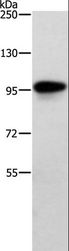 TRAF3IP1 Antibody - Western blot analysis of Human brain malignant glioma tissue, using TRAF3IP1 Polyclonal Antibody at dilution of 1:500.