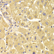 TRAF3IP2 / ACT1 Antibody - Immunohistochemistry of paraffin-embedded Human liver injury tissue.