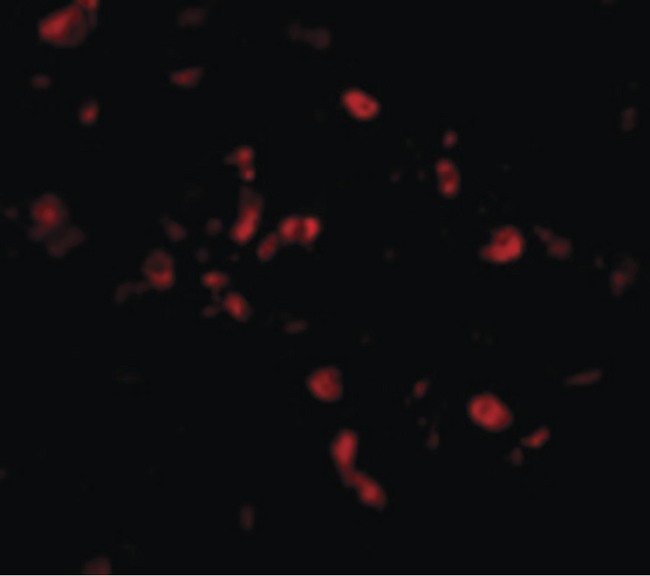 TRAF3IP2 / ACT1 Antibody - Immunofluorescence of CIKS in Human Lung cells with CIKS antibody at 20 ug/ml.