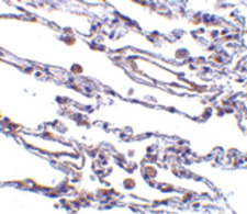 TRAF3IP2 / ACT1 Antibody - Immunohistochemistry of CIKS in human lung tissue with CIKS antibody at 5 ug/ml.