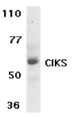 TRAF3IP2 / ACT1 Antibody - Western blot of CIKS expression in human placenta tissue lysate with CIKS antibody at 1 ug /ml.