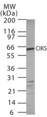 TRAF3IP2 / ACT1 Antibody - Western blot of CIKS using antibody on 15 ugs of mouse kidney cell lysate.
