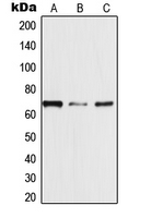 TRAF3IP3 Antibody - Western blot analysis of TRAF3IP3 expression in MDAMB453 (A); Jurkat (B); HeLa (C) whole cell lysates.