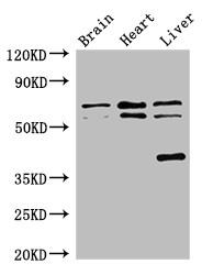 TRAF3IP3 Antibody - Positive WB detected in:Mouse brain tissue,Rat heart tissue,Rat liver tissue;All lanes:TRAF3IP3 antibody at 2.7?g/ml;Secondary;Goat polyclonal to rabbit IgG at 1/50000 dilution;Predicted band size: 64,62,41 KDa;Observed band size: 64,62,41 KDa;