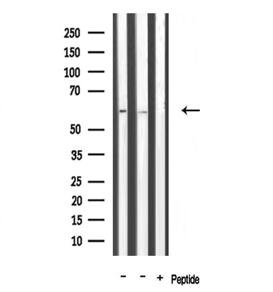 TRAF3IP3 Antibody - Western blot analysis of extracts of various samples using T3JAM antibody.