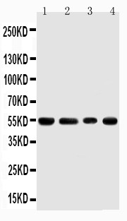 TRAF4 Antibody - WB of CART1 / TRAF4 antibody. Lane 1: Rat Thymus Tissue Lysate. Lane 2: HELA Cell Lysate. Lane 3: JURKAT Cell Lysate. Lane 4: HEPA Cell Lysate.