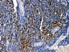 TRAF4 Antibody - CART1 / TRAF4 antibody. IHC(P): Rat lymphonodus Tissue.