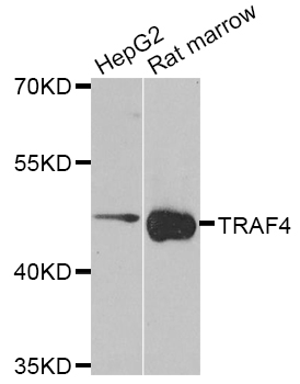 TRAF4 Antibody - Western blot analysis of extracts of various cell lines.