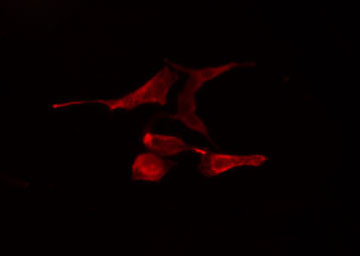 TRAF4 Antibody - Staining NIH-3T3 cells by IF/ICC. The samples were fixed with PFA and permeabilized in 0.1% Triton X-100, then blocked in 10% serum for 45 min at 25°C. The primary antibody was diluted at 1:200 and incubated with the sample for 1 hour at 37°C. An Alexa Fluor 594 conjugated goat anti-rabbit IgG (H+L) antibody, diluted at 1/600, was used as secondary antibody.