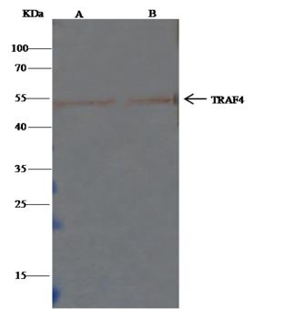 TRAF4 Antibody - TRAF4 was immunoprecipitated using: Lane A: 0.5 mg 293T Whole Cell Lysate. Lane B: 0.5 mg Hela Whole Cell Lysate. 4 uL anti-TRAF4 rabbit polyclonal antibody and 60 ug of Immunomagnetic beads Protein G. Primary antibody: Anti-TRAF4 rabbit polyclonal antibody, at 1:100 dilution. Secondary antibody: Clean-Blot IP Detection Reagent (HRP) at 1:500 dilution. Developed using the DAB staining technique. Performed under reducing conditions. Predicted band size: 52 kDa. Observed band size: 52 kDa.