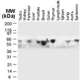 TRAF5 Antibody - Western blot of TRAF5 in normal human tissues using Polyclonal Antibody to TRAF5 at 1:2000. TRAF5 is observed at ~64 kD. Additional bands of lower molecular weight were seen in some cases, and may represent TRAF5 degradation fragments