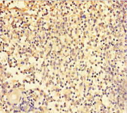 TRAF5 Antibody - Immunohistochemistry of paraffin-embedded human spleen tissue using TRAF5 Antibody at dilution of 1:100