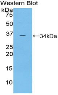 TRAF5 Antibody - Western blot of recombinant TRAF5.  This image was taken for the unconjugated form of this product. Other forms have not been tested.