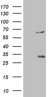 TRAF5 Antibody - HEK293T cells were transfected with the pCMV6-ENTRY control. (Left lane) or pCMV6-ENTRY TRAF5. (Right lane) cDNA for 48 hrs and lysed. Equivalent amounts of cell lysates. (5 ug per lane) were separated by SDS-PAGE and immunoblotted with anti-TRAF5. (1:500)